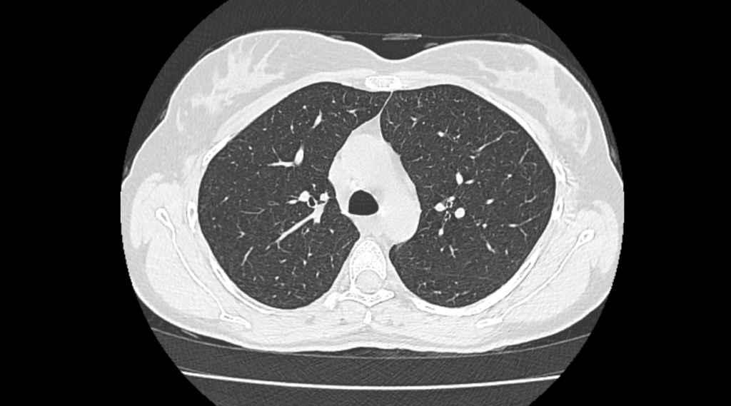 Medical Imaging